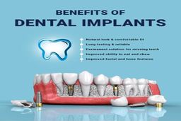 بررسی مزایا و معایب ایمپلنت دندان
