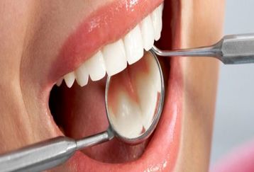 نکات طلایی برای مراقبت از دندان ها