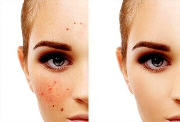 هنگام خرید ضد لک به چه نکاتی توجه کنیم؟