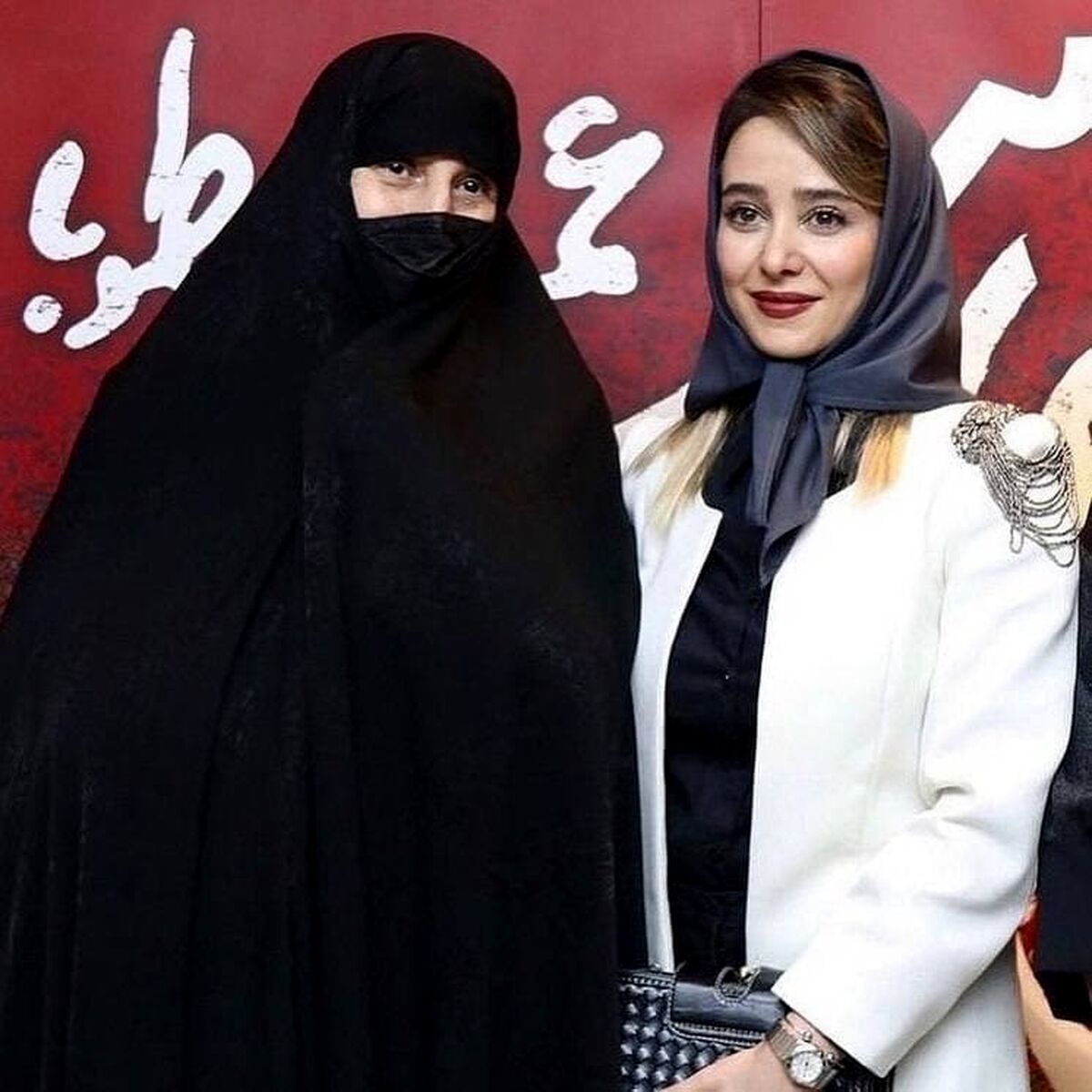 چهره ترسناک الناز حبیبی | بلایی که  خانم بازیگر سر چهره اش آورد + عکس