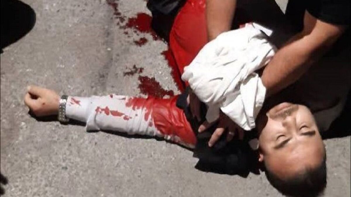 حمله خونین مزاحمین نوامیس به یک آتش‌نشان در تهران | درگیری آتش‌نشان غیرتمند با اراذل و مزاحمین نوامیس +(عکس ۱۸+) 