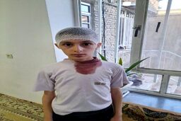 معلم اشنویه‌ای، سر دانش آموز را شکست+عکس