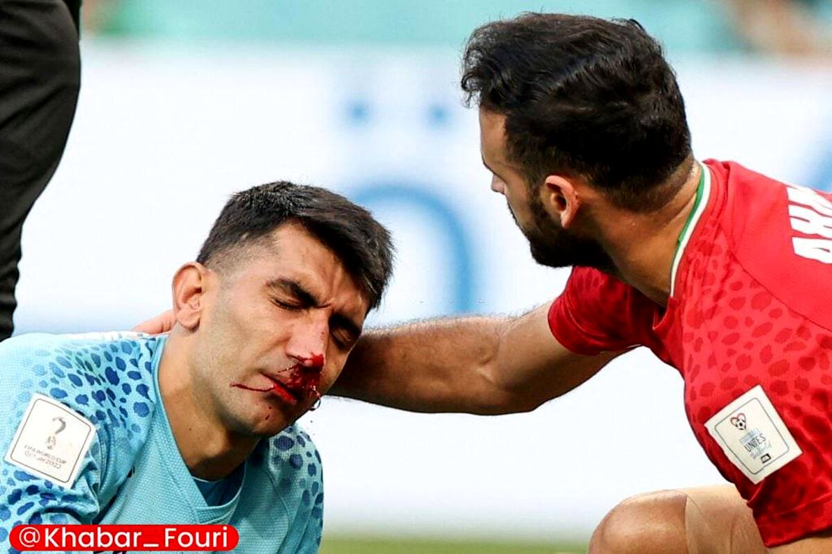 علیرضا بیرانوند جام جهانی را از دست داد