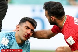  کار علیرضا بیرانوند به جراحی کشید