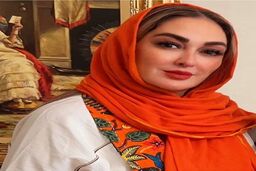 عکس لو رفته از الهام حمیدی قبل و بعد از عمل زیبایی جنجال به پا کرد! | الهام حمیدی از اول کوبیده ساخته! + عکس