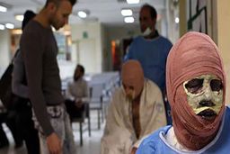 انفجار هولناک ترقه های دست ساز چهارشنبه سوری | 2 جوان راهی بیمارستان شدند