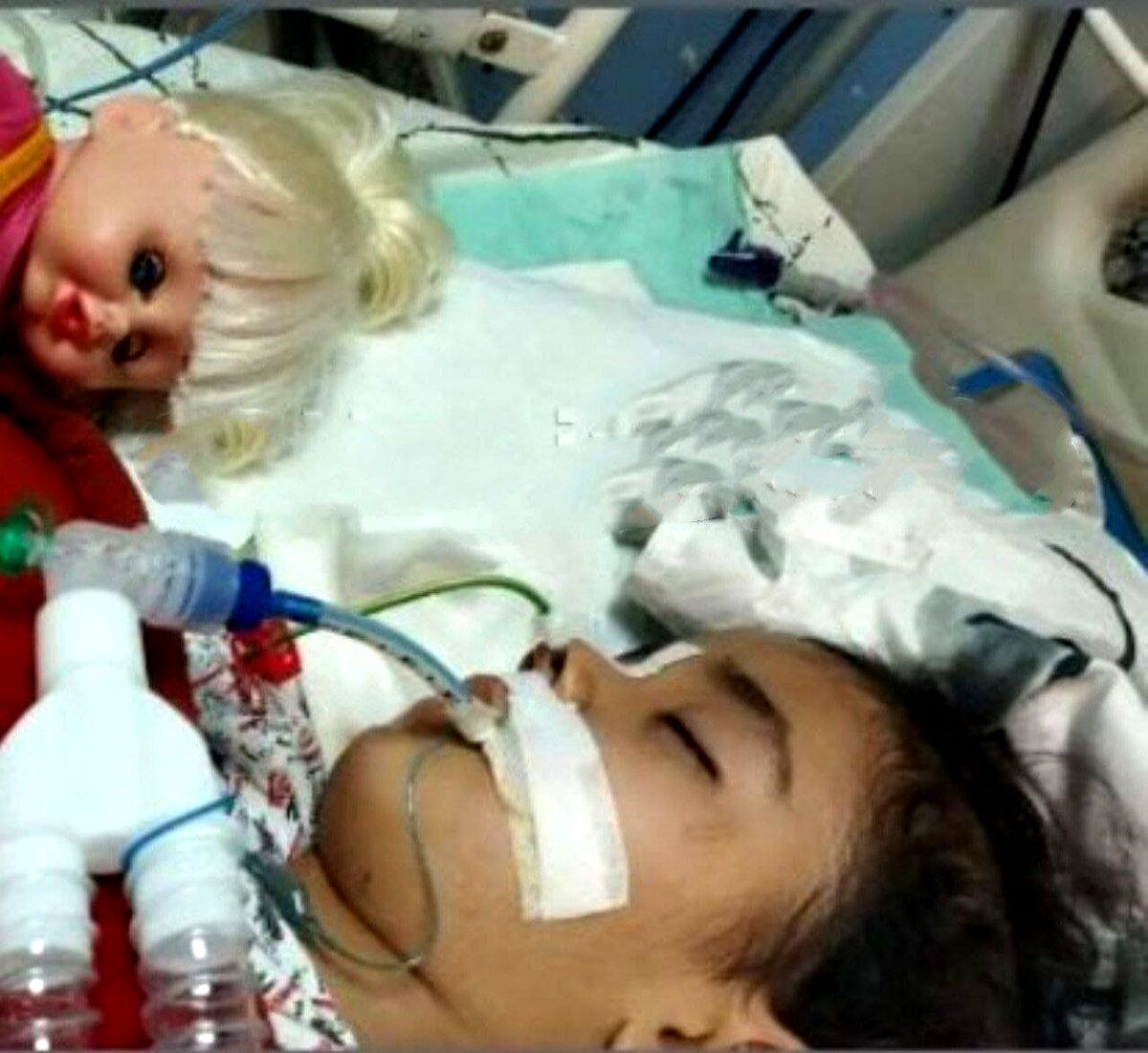 آوا کوچولو آسمانی شد | فوت دختر 4 ساله ارومیه ای بر اثر شکنجه های نامادری اش + عکس و جزییات