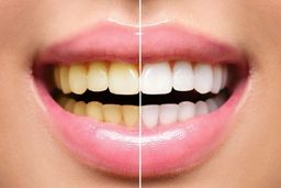 این 10 کار را انجام بدهید دندان هایتان سالم می ماند + اینفوگرافیک