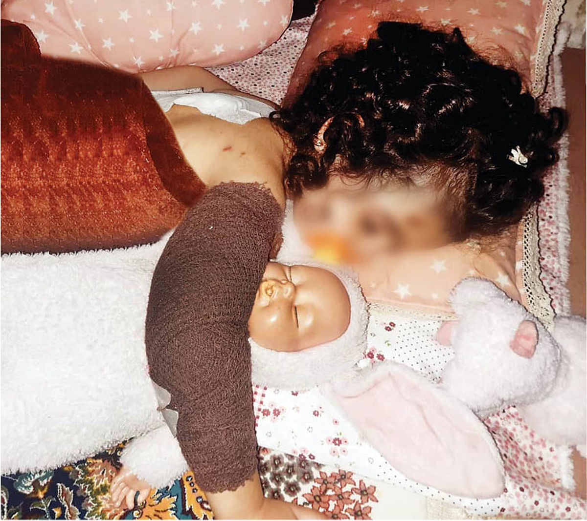 عکس تلخ از حمله خونین سگهای ولگرد به دختر ۳ساله کرجی