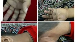 تنبیه بدنی وحشتناک دانش آموز ایلامی/ ورود دادستان به ماجرا+تصاویر
