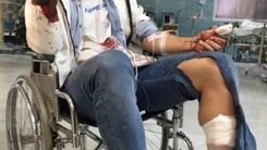 فوتبالیست معروف سلاخی شد/ سارقان او را با چاقو سلاخی کردن