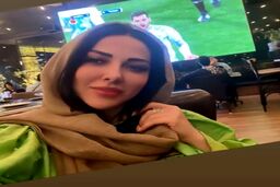 باورتان نمی شود لیلا اوتادی قبلا چه شکلی بوده ؟ ! | لیلا اوتادی با عمل زیبابی اسکارلت جوهانسون شد + عکس