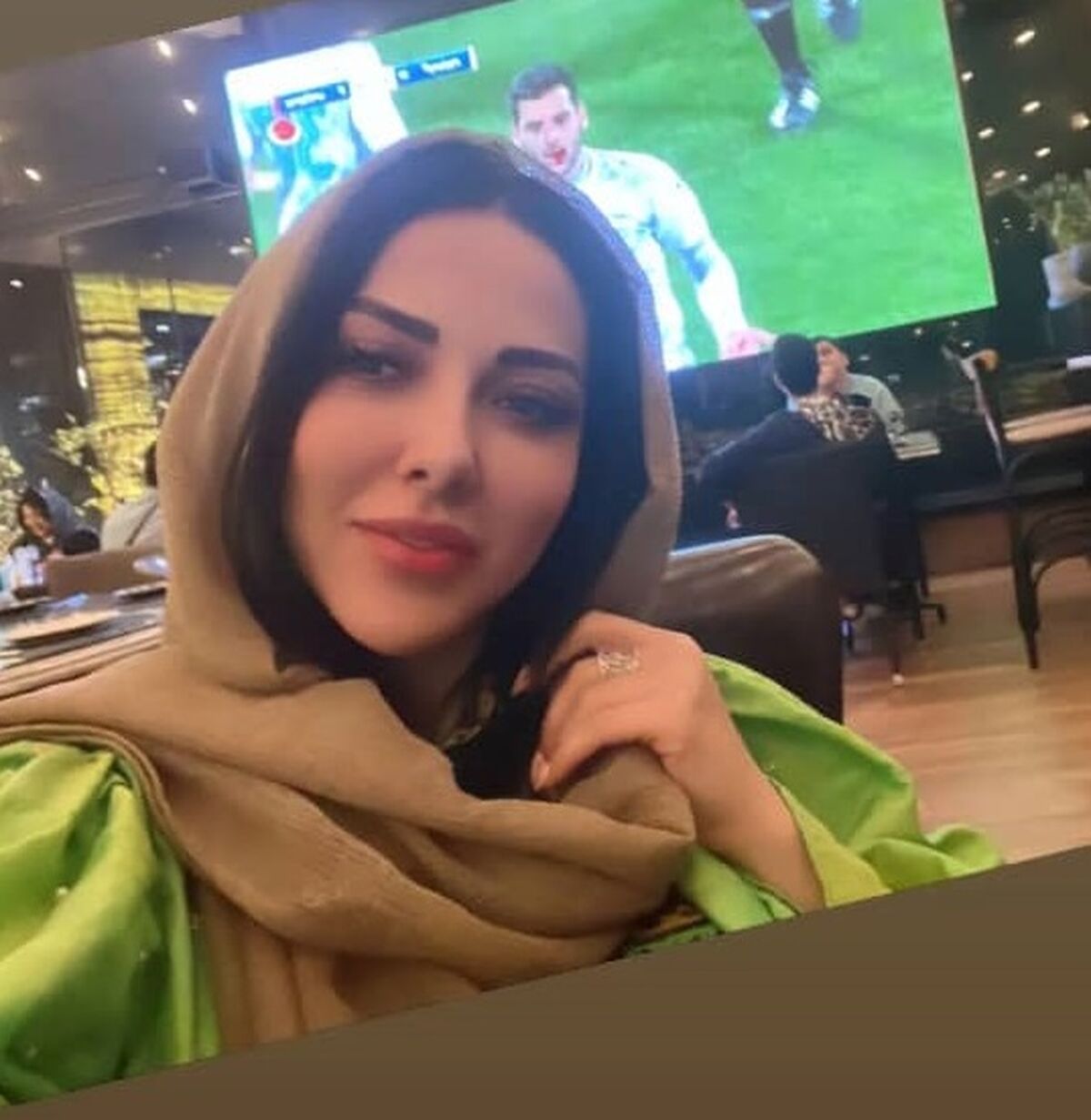 لیلا اوتادی خواست زیبا شود ولی برعکس شد| عمل های زیبایی لیلا اوتادی را زشت کرد+عکس جنجالی