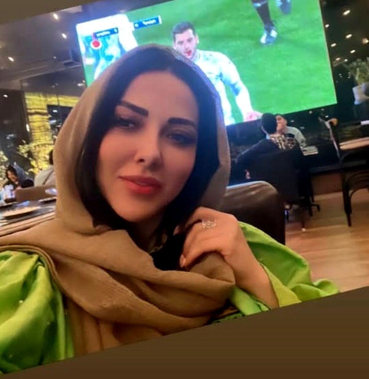 باورتان نمی شود لیلا اوتادی قبلا چه شکلی بوده ؟ ! | لیلا اوتادی با عمل زیبابی اسکارلت جوهانسون شد + عکس