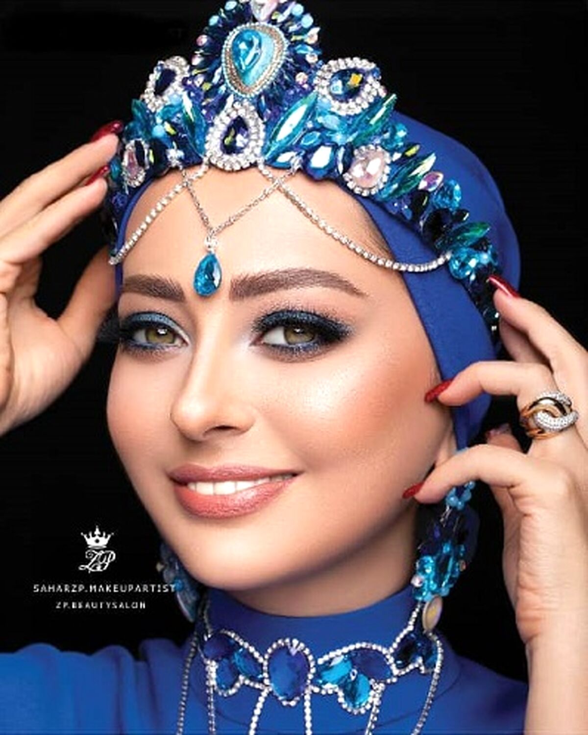 ازدواج دوم به نفیسه روشن ساخت!/با تزریق های زیبایی از بیست سالگیش هم جوانتر شد!+عکس