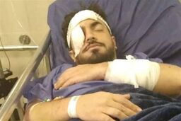 ـآخوندی که مورد حمله افراد قرار گرفت راهی بیمارستان شد! + عکس