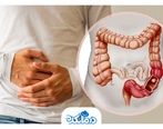 سرطان روده بزرگ؛ علائم، انواع، آزمایش و راه‌کارهای درمانی آن