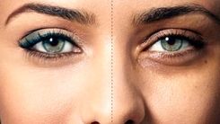 چگونه سیاهی دور چشم را ازبین ببریم؟