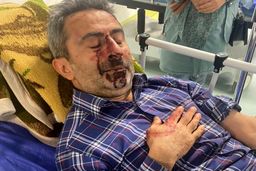 سوءقصد به جان عضو هیات‌مدیره شهر جدید هشتگرد +عکس