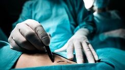 مرگ وحشتناک زن جوان به خاطر ۱۵ کیلو اضافه‌وزن
