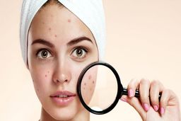 معجزه این ویتامین برای درمان جوش و آکنه صورت