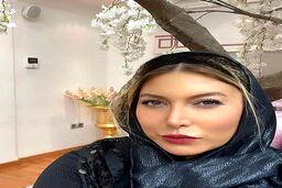 فریبا نادری ام دماغ عملی شد | عکس جدید فریبا نادری غوغا بپا کرد