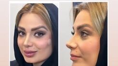 پشیمانی صبا راد بعد از منتشر کردن این عکسش | چهره ترسناک صبا راد بعد از بیرون آمدن از مطب دکتر جراحی زیبایی +عکس