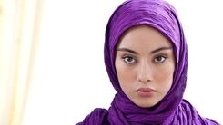 اسیدپاشی روی خانم بازیگر / ترلان پروانه از دست رفت! +عکس