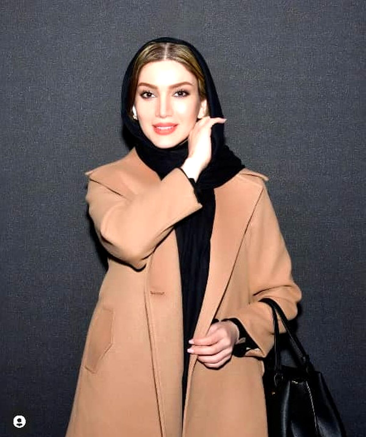 متین ستوده بعد از ازدواج از این رو به اون رو شد!/ عمل های زیبایی خانم بازیگر ازش فرشته ساخت!+عکس