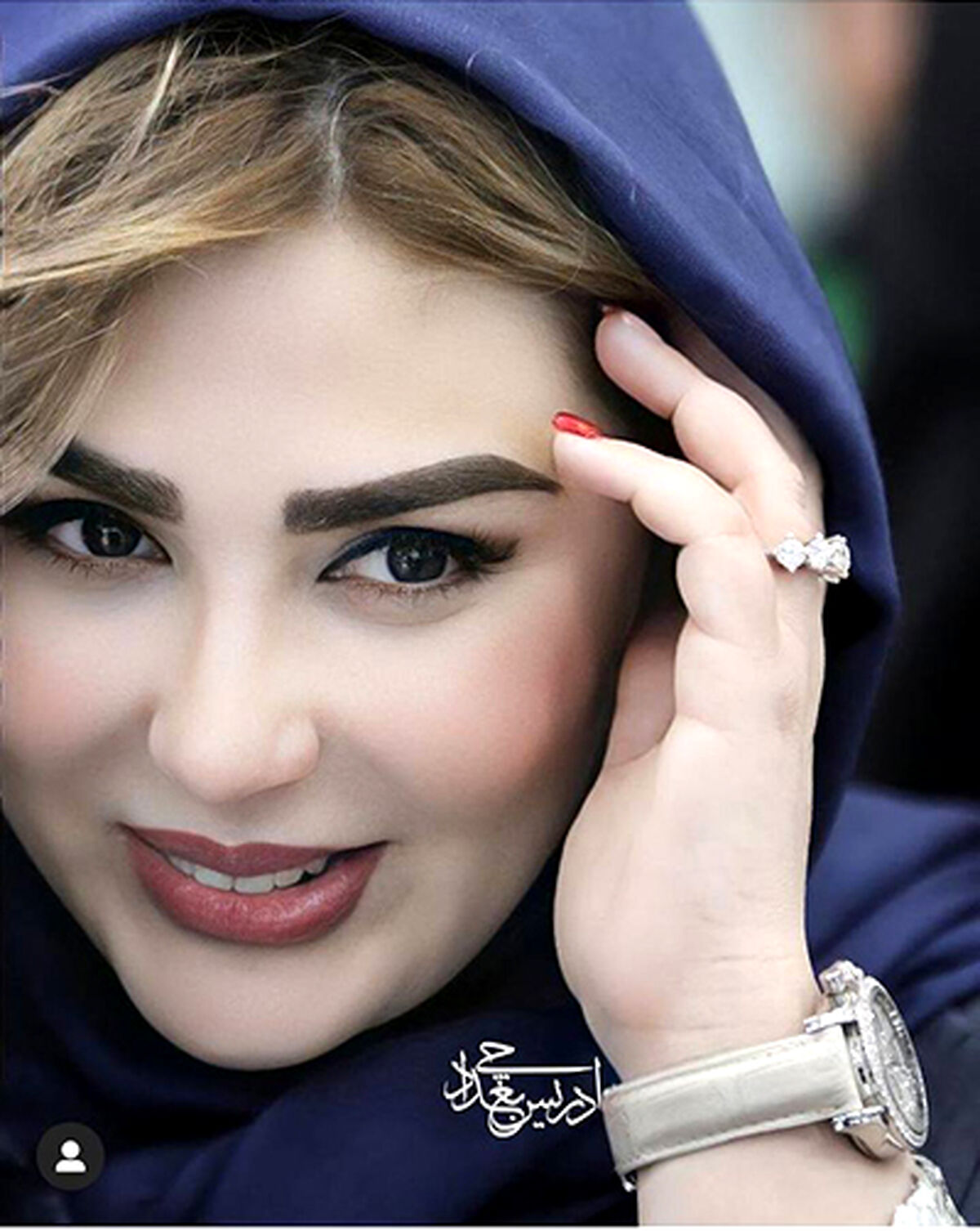 نیوشا ضیغمی چه اشتباهی کرد این استوری را گذاشت | عکس تازه منتشر شده از چهره قبل از عمل زیبایی نیوشا ضیغمی |  نیوشا ضیغمی با خودش چه کار کرد +عکس باورنکردنی
