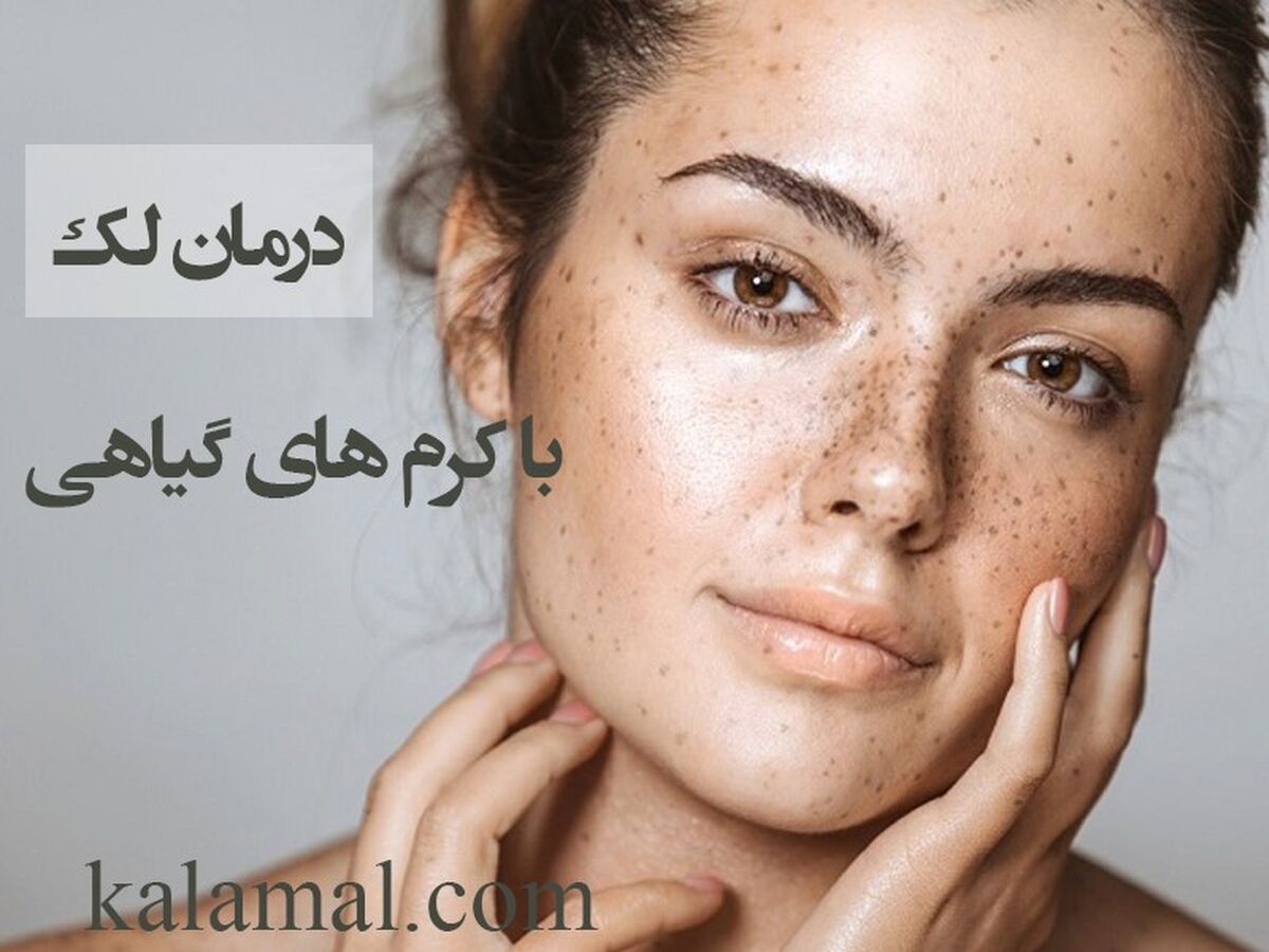 چه کرم های گیاهی را بخریم که بیشترین اثر بخشی را داشته باشند؟