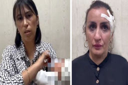 جنایت مادر سنگدل برای انجام عمل زیبایی بینی| فروش نوزاد ۵ روزه لو رفت+عکس