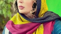 چهره قبلی نیوشا ضیغمی قبل از جراحی زیبایی لو رفت | تفاوت دو عکس نیوشا ضیغمی معجزه عمل زیبایی +عکس 