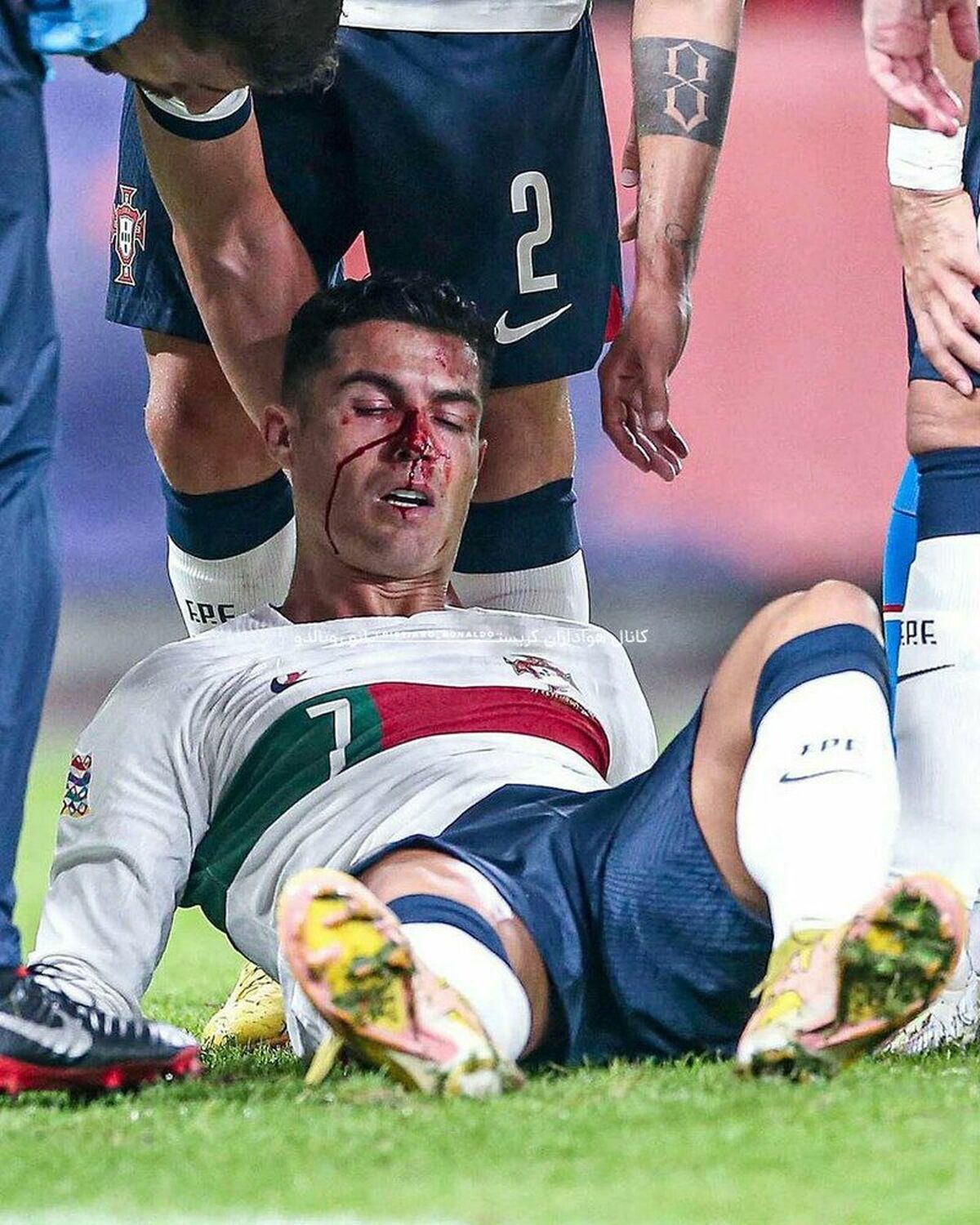 صورت رونالدو خونین شد +عکس