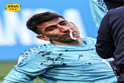 تصمیم عجیب و غریب بیرانوند در جام جهانی جنجال به پا کرد !