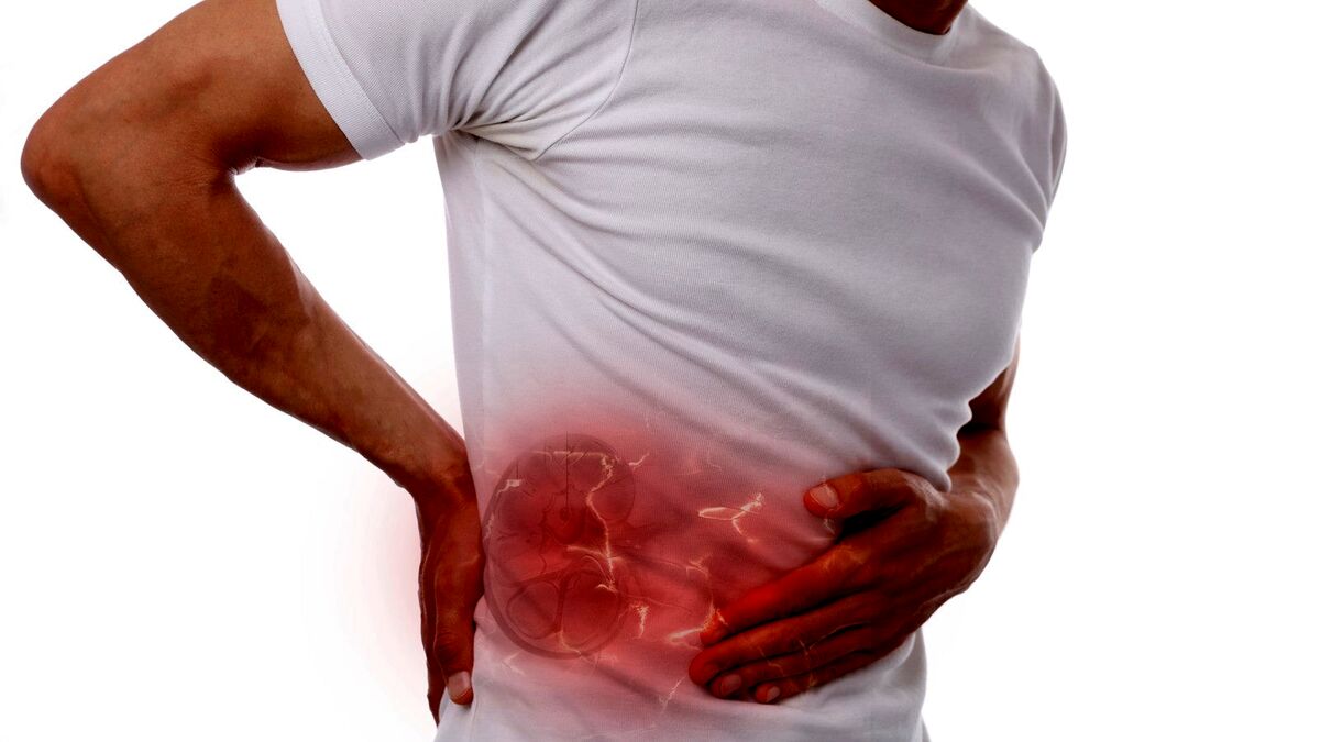 آیا سنگ کلیه میتواند در ناتوانی جنسی اثرگذار باشد؟