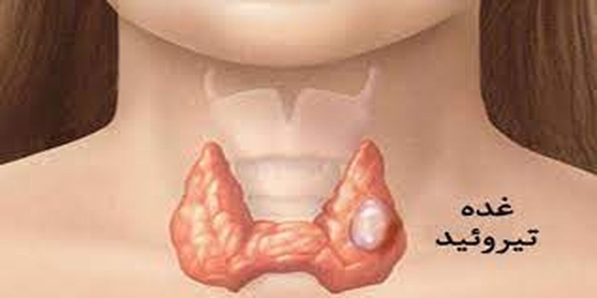 تیروئید کم‌کار را در خانه درمان کنید  | ۵ درمان طبیعی خانگی کم کاری تیروئید | این افراد غلات را حذف کنند