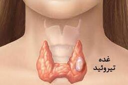 اگر کم کاری تیروئید دارید بخوانید |  بهترین رژیم غذایی برای مبتلایان کم‌کاری تیروئید