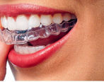 ارتودنسی نامرئی؛ هرآنچه باید بدانید!