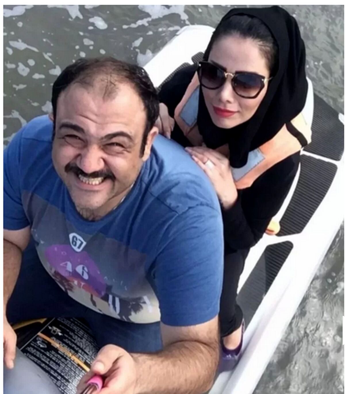 بلایی که دکترا سر چهره همسر مهران غفوریان آوردند | چهره ترسناک عیال مهران غفوریان | مهران غفوریان زنش را نشناخت +عکس جنجالی