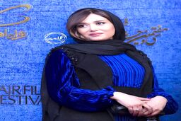 اتفاق وحشتناک باورنکردنی برای صورت پریناز ایزدیار | پریناز ایزدیار یک چشمش را از دست داد + عکس