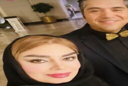صبا راد با عمل زیبایی جدید مثل همه عملی ها شد | خانم صبا راد به نظرت بس نیست؟