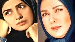 اتفاق وحشتناک اسید پاشی امروز صبح برای لعیا زنگنه | چهره لعیا زنگنه دیگر قابل شناسایی نیست +عکس (18+) از لعیا زنگنه