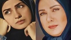 اتفاق وحشتناک اسید پاشی امروز صبح برای لعیا زنگنه | چهره لعیا زنگنه دیگر قابل شناسایی نیست +عکس (18+) از لعیا زنگنه
