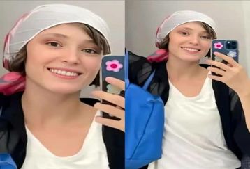 صورت کبود و ورم کرده فرشته حسینی بعد کتک خوردن از آقای بازیگر | چه بلایی نوید سر فرشته آورد؟