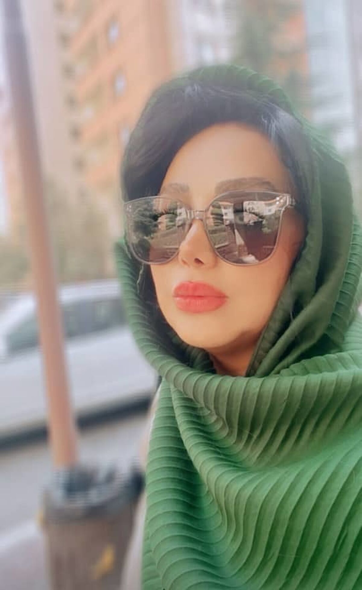 عکس باور نکردنی از ۱۹ سالگی بهنوش بختیاری | بهنوش بختیاری قبل عمل بینی چه شکلی بود؟