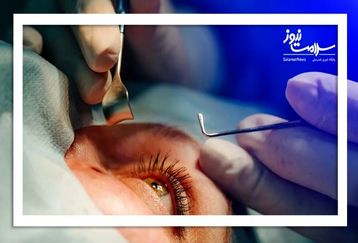 همه چیز درباره آب مروارید | از کجا بفهمیم آب مروارید داریم؟ | برای آنکه آب مروارید نگیریم چی بخوریم؟