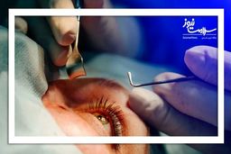 همه چیز درباره آب مروارید | از کجا بفهمیم آب مروارید داریم؟ | برای آنکه آب مروارید نگیریم چی بخوریم؟