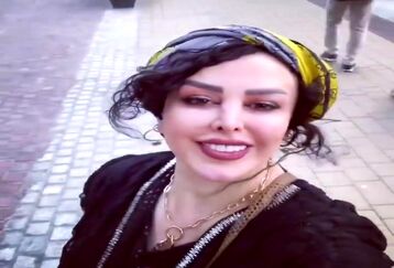 تغییر چهره باورنکردنی فلور نظری با عمل زیبایی جدید /خانم بازیگر شبیه سحرتبر شد +عکس شوکه کننده