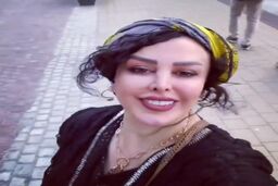 تغییر چهره باورنکردنی فلور نظری با عمل زیبایی جدید /خانم بازیگر شبیه سحرتبر شد +عکس شوکه کننده
